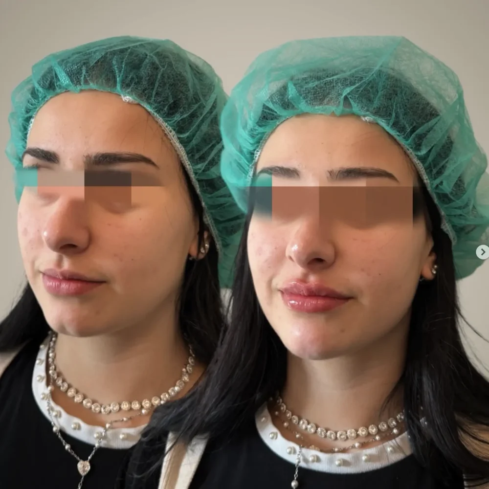 Screenshot 2026-03-27 alle 10.37.16