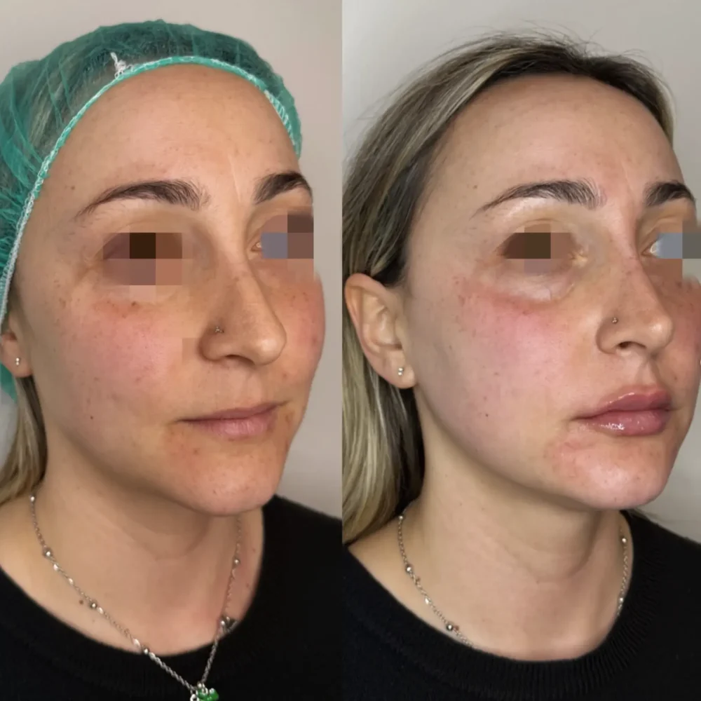 Screenshot 2026-03-27 alle 10.37.29