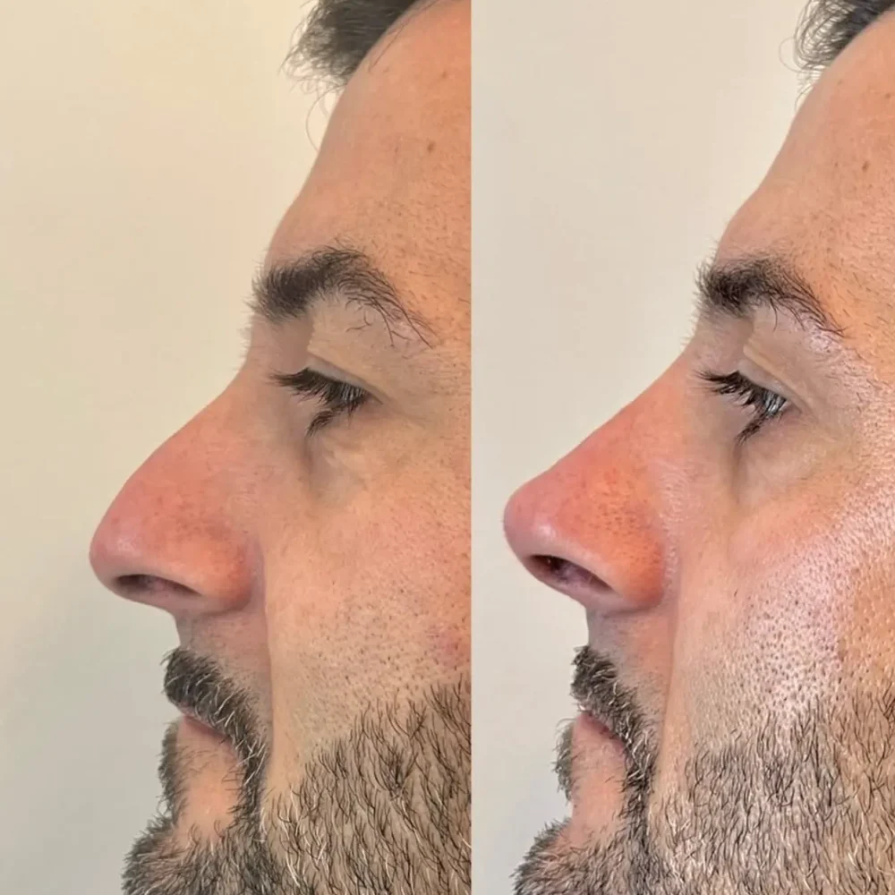 Screenshot 2026-03-27 alle 10.37.52