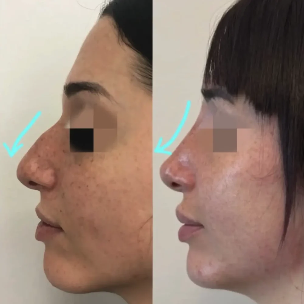 Screenshot 2026-03-27 alle 10.38.09