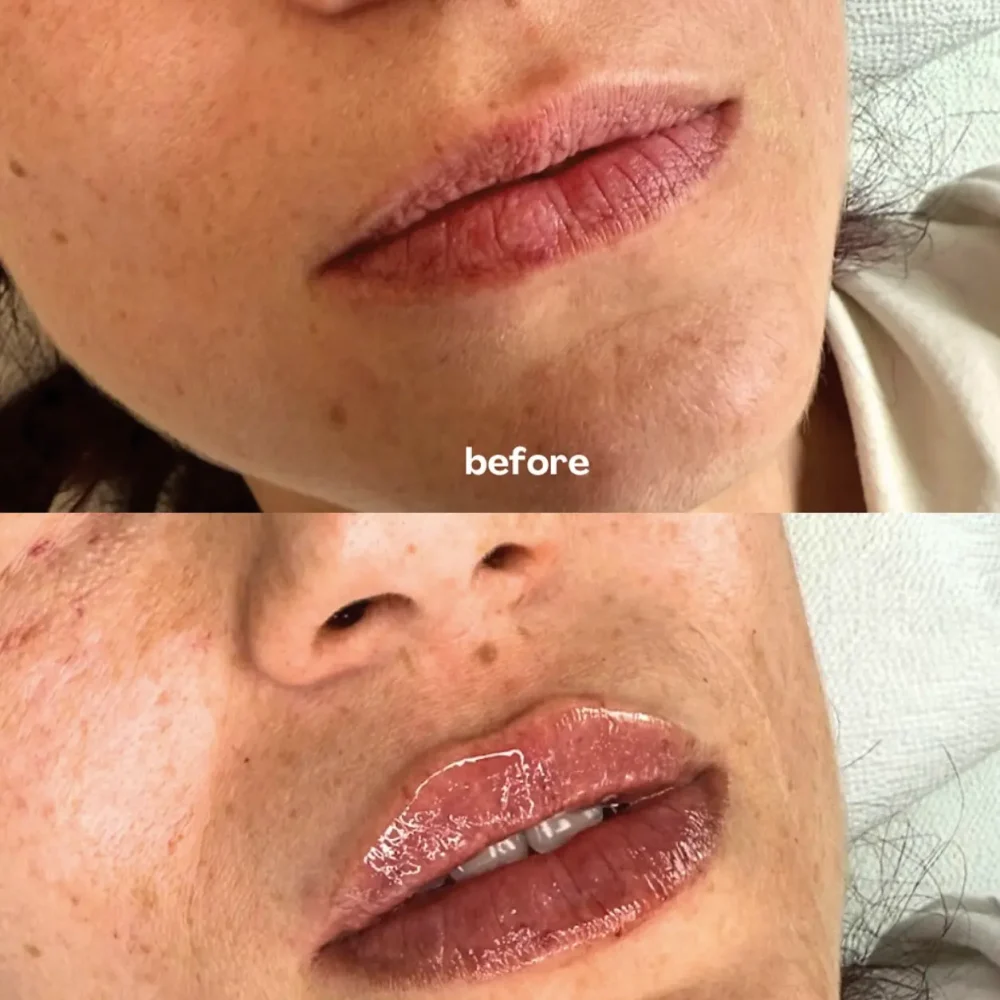 Screenshot 2026-03-27 alle 10.39.00