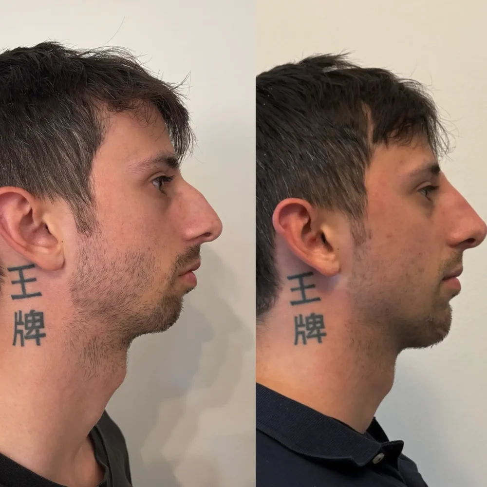 Screenshot 2026-03-27 alle 10.46.04