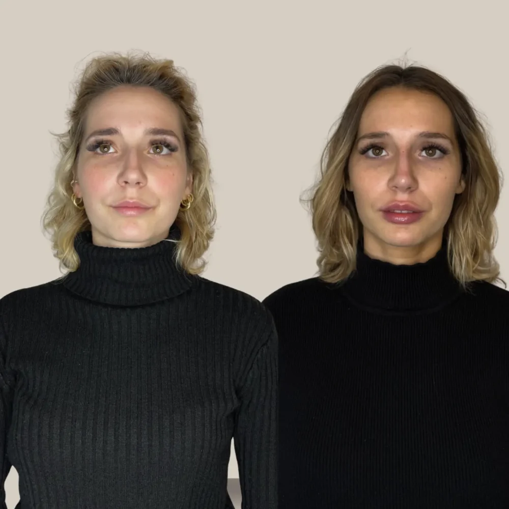 Screenshot 2026-03-27 alle 10.46.23