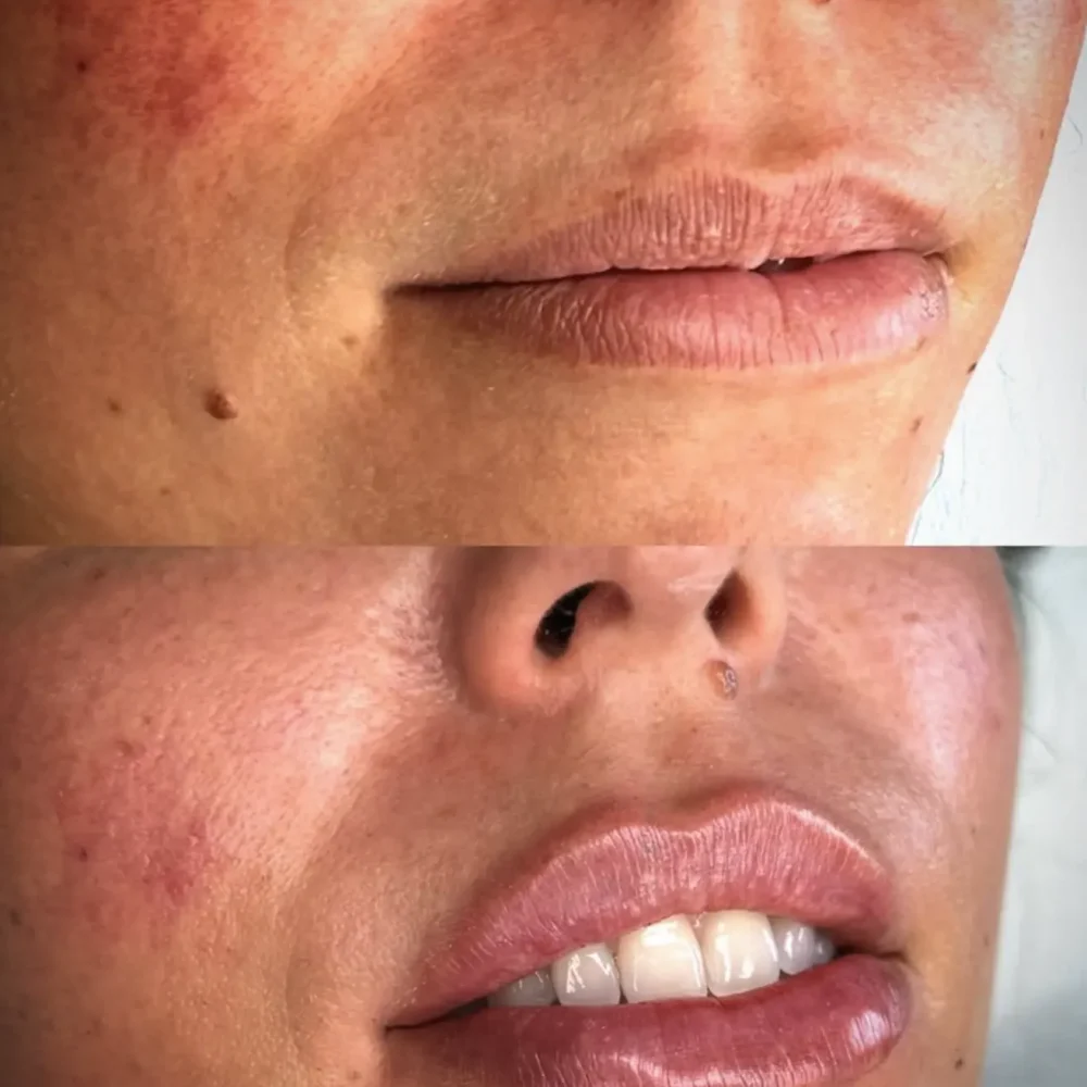 Screenshot 2026-03-27 alle 10.46.40